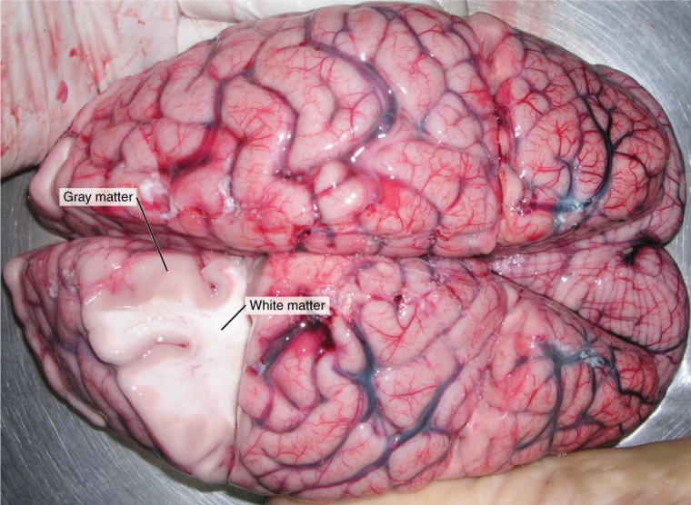 Photograph of a human brain with a small section removed to demonstrate the difference between white and grey matter. The grey matter appears much darker than the white matter.