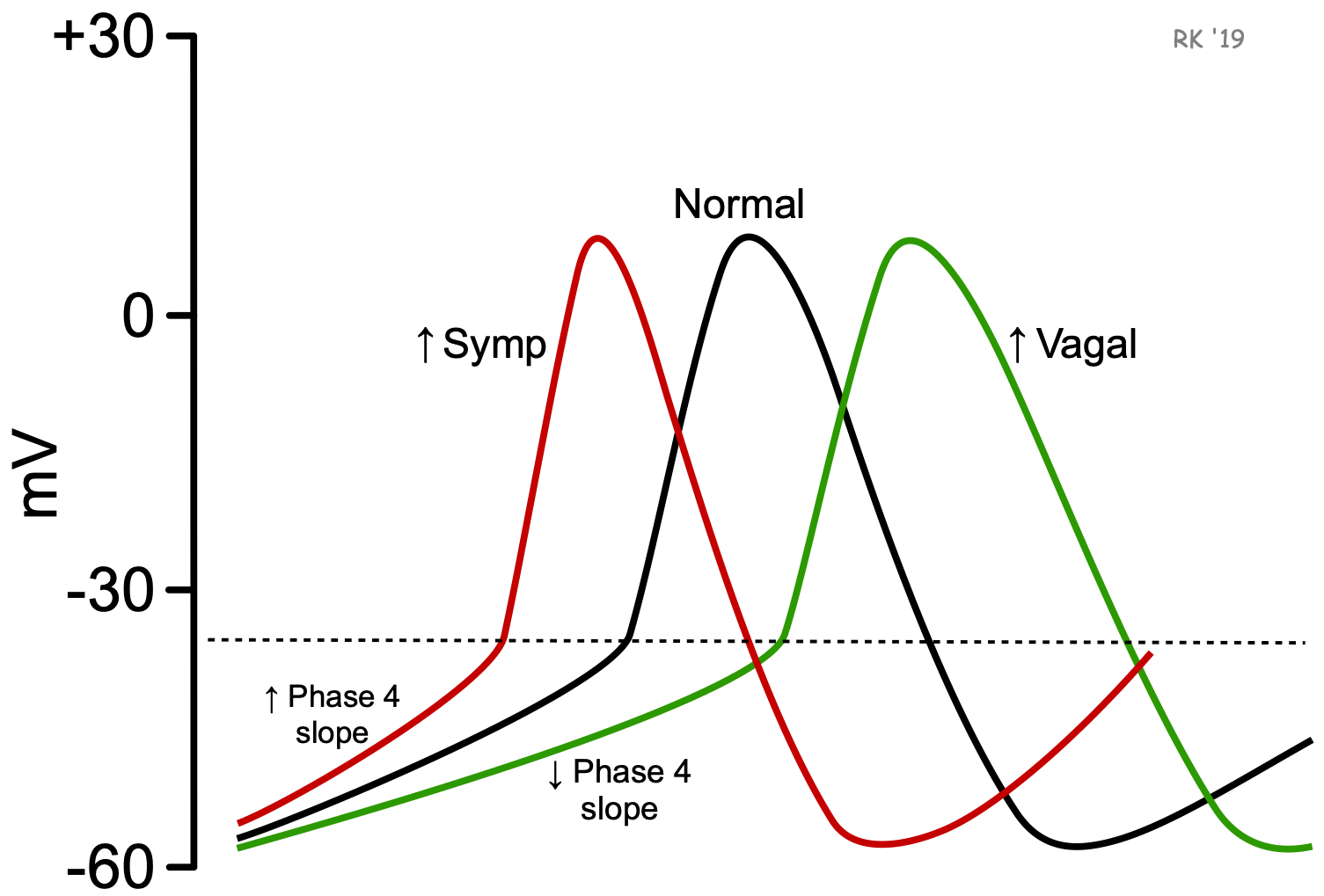 Diagram explaining the influence of the Sympathetic and Parasympathetic Nervous System on the action potential profile of a nodal cell. The opposing effects of the sympathetic (red) and parasympathetic (green) nervous system on the action potential of a nodal cell. With an increase in sympathetic nervous system stimulation, the membrane potential reaches the threshold at a much quicker pace; therefore, the action potential profile becomes more rapid. However, with increased parasympathetic nervous system activity reflected through stimulation of the vagus nerve, the membrane takes much longer to reach the threshold. As a result, the action potential profile is lengthened.