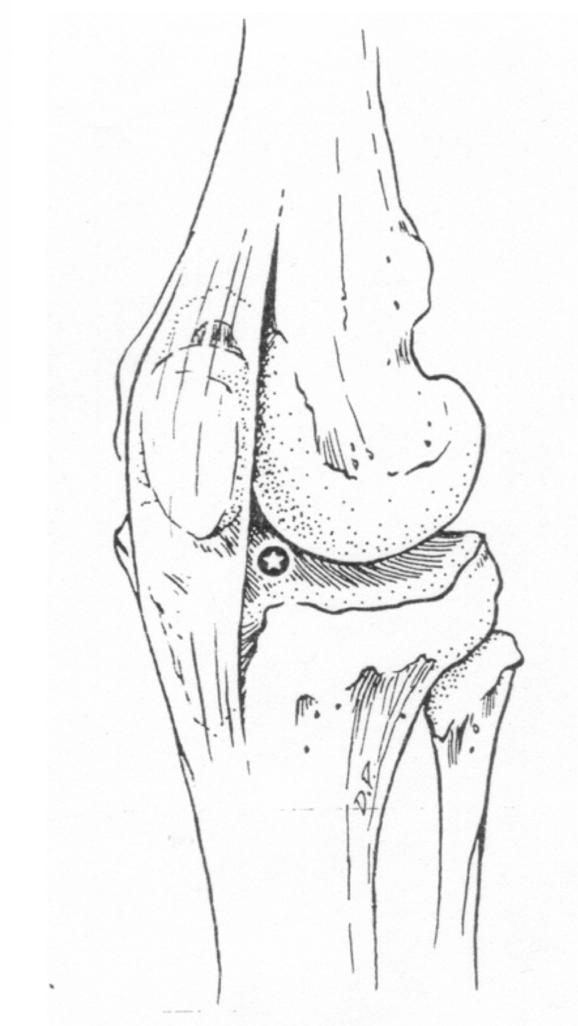 Arthrocentesis – VETM 4540: Medical Procedures