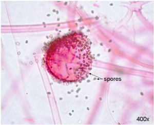 Image of spores formed by fungi